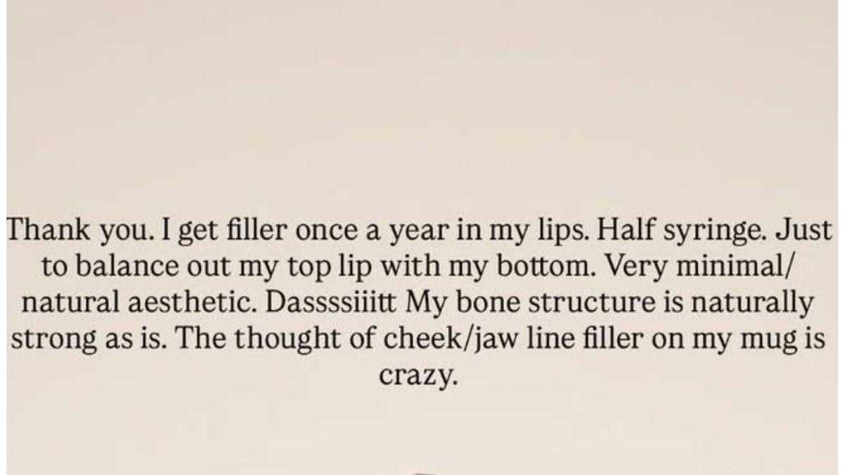 Photo of Kayla Nicole opened up about her yearly cosmetic procedure.