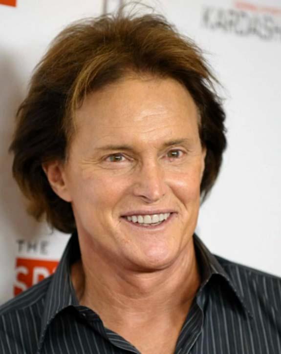 //bruce_jenner_plastic_surgery_jibes_jimmy_falon_video_stack_