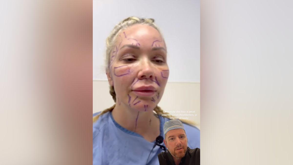 Image of Bunnie Xo seemed thrilled by her facelift results.