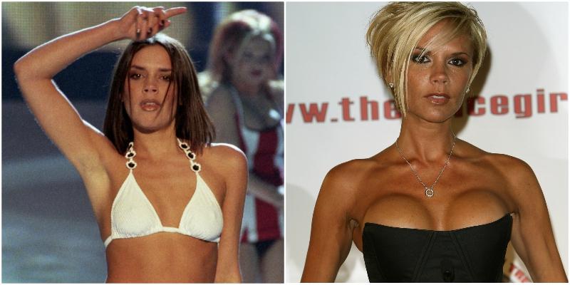 Celebrities with Breast Implants  Before & After Photos - Vantage