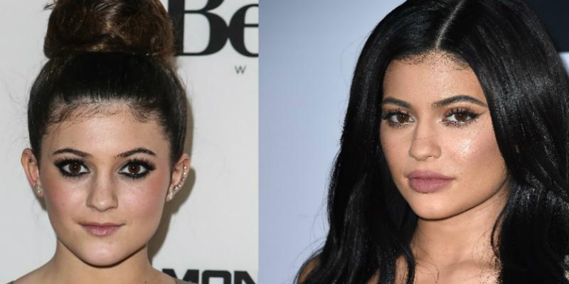 New And Improved! The Top 15 Celebrity Plastic Surgeries ...