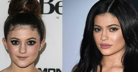 Kylie jenner plastic surger feature image