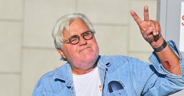 jay leno debuts new face after gasoline fire accident photos