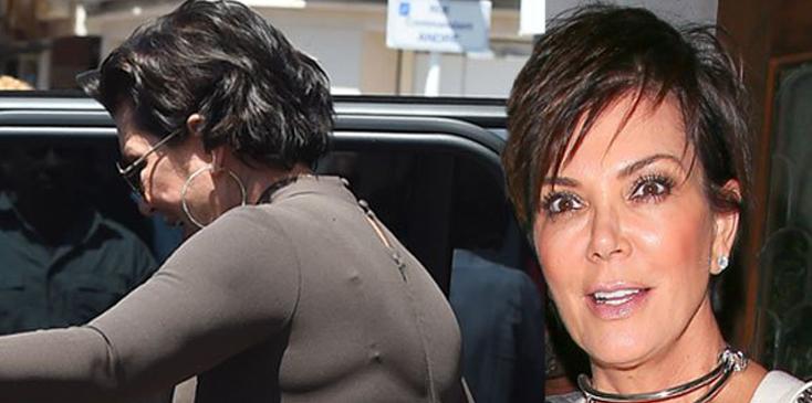 Kris jenner plastic surgery face lift body weight gain holidays hero