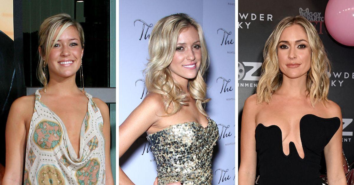 Kristin Cavallari'S Amazing Transformation: Before & After Photos - j5giet7