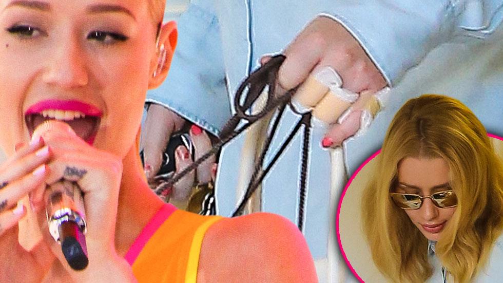 Iggy azalea tattoo removed breakup