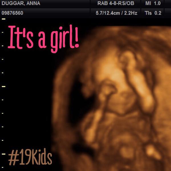 Josh anna duggar baby gender ultrasound photos 08