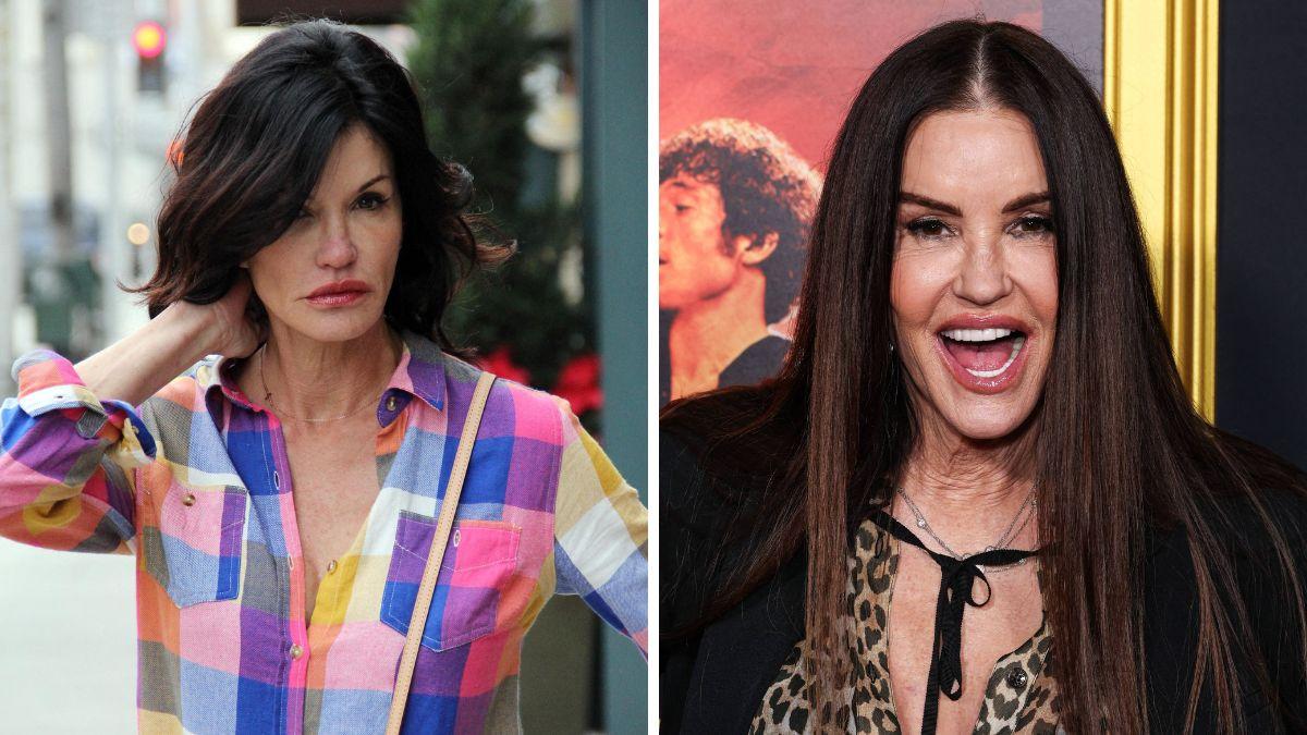celebrities who got facelifts before after photos