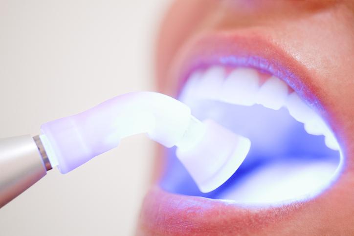 Female patient in deltal office receiving dental filling drying procedure