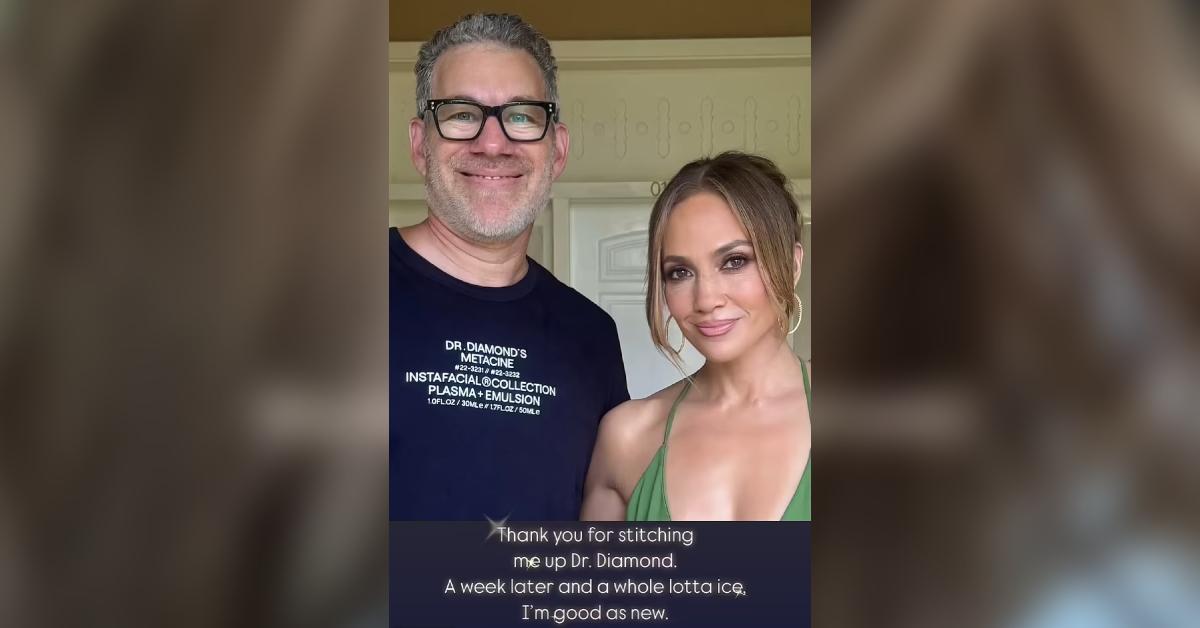 jennifer lopez stitches injury american music awards rehearsal photos