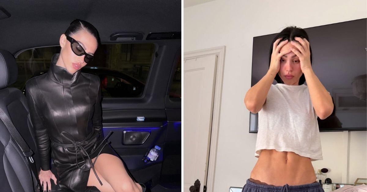 image of Lisa Rinna's daughter previously opened up about her cosmetic procedures.