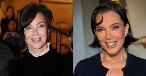 Kris Jenner Spills Details On Facelift & Reveals Who Came To Surgery