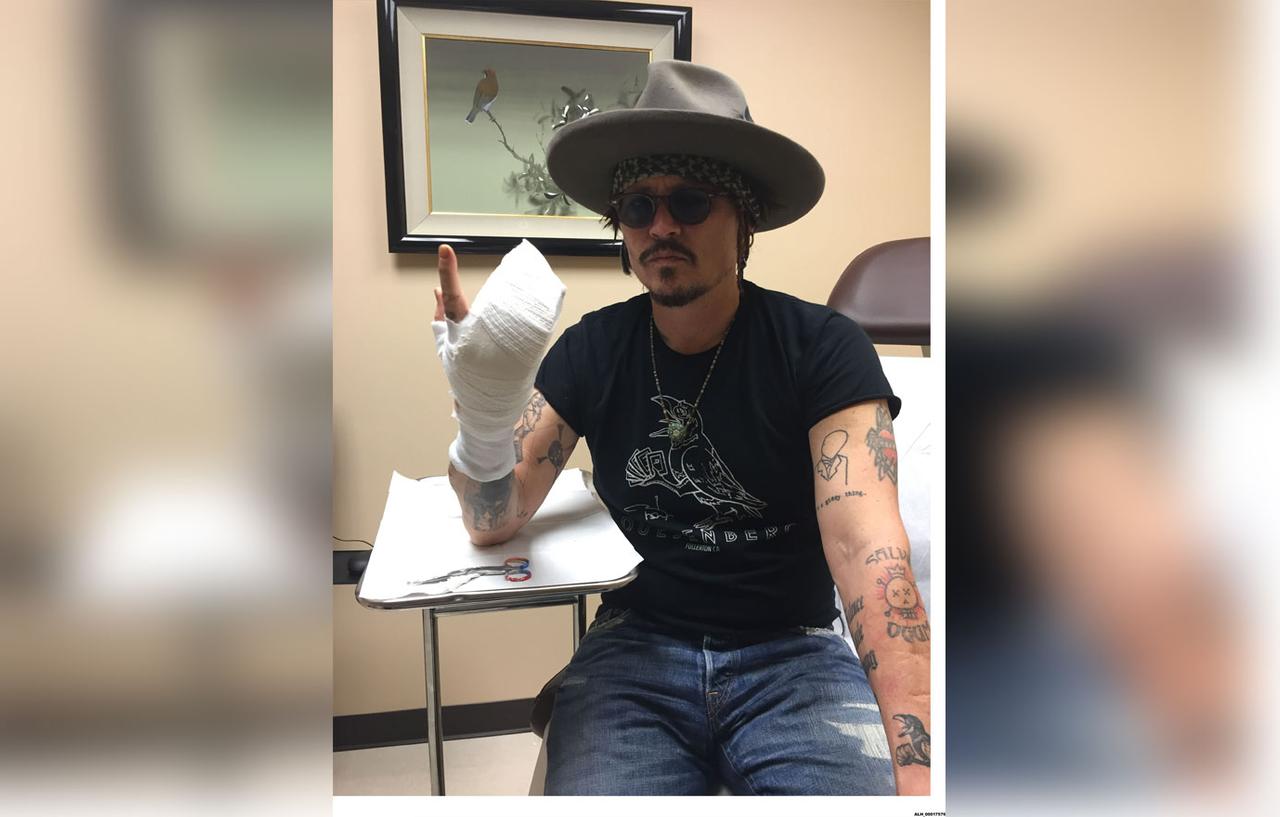 Johnny Depp Jokes About Damaged Finger