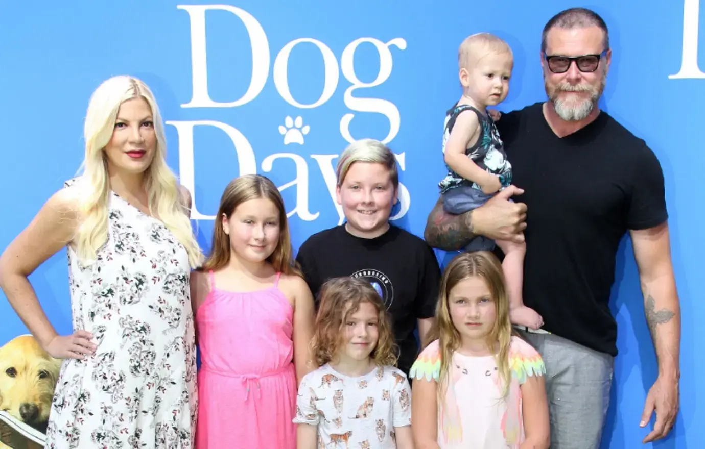 tori spelling son liam  foot surgery fall down stairs