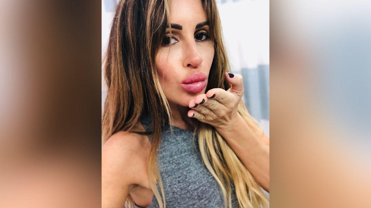 rachel uchitel dramatic facelift transformation before after photos