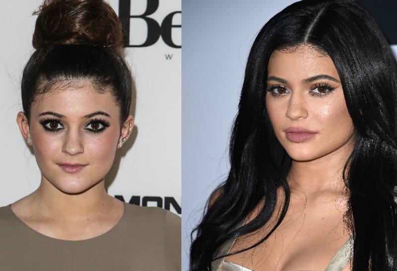 New And Improved! The Top 15 Celebrity Plastic Surgeries For The Win