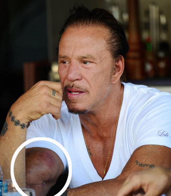 Mickey Rourke looking very slim but sporting some strange brusin