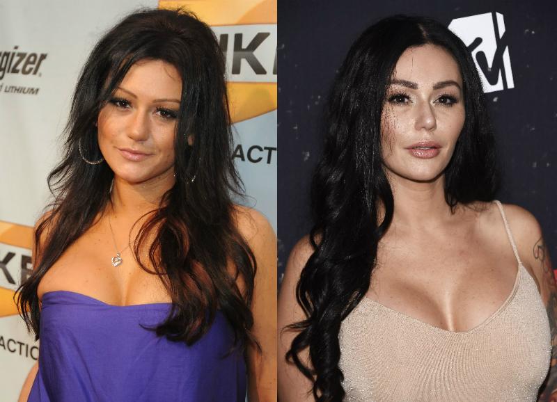 Jwoww celebrity plastic surgery