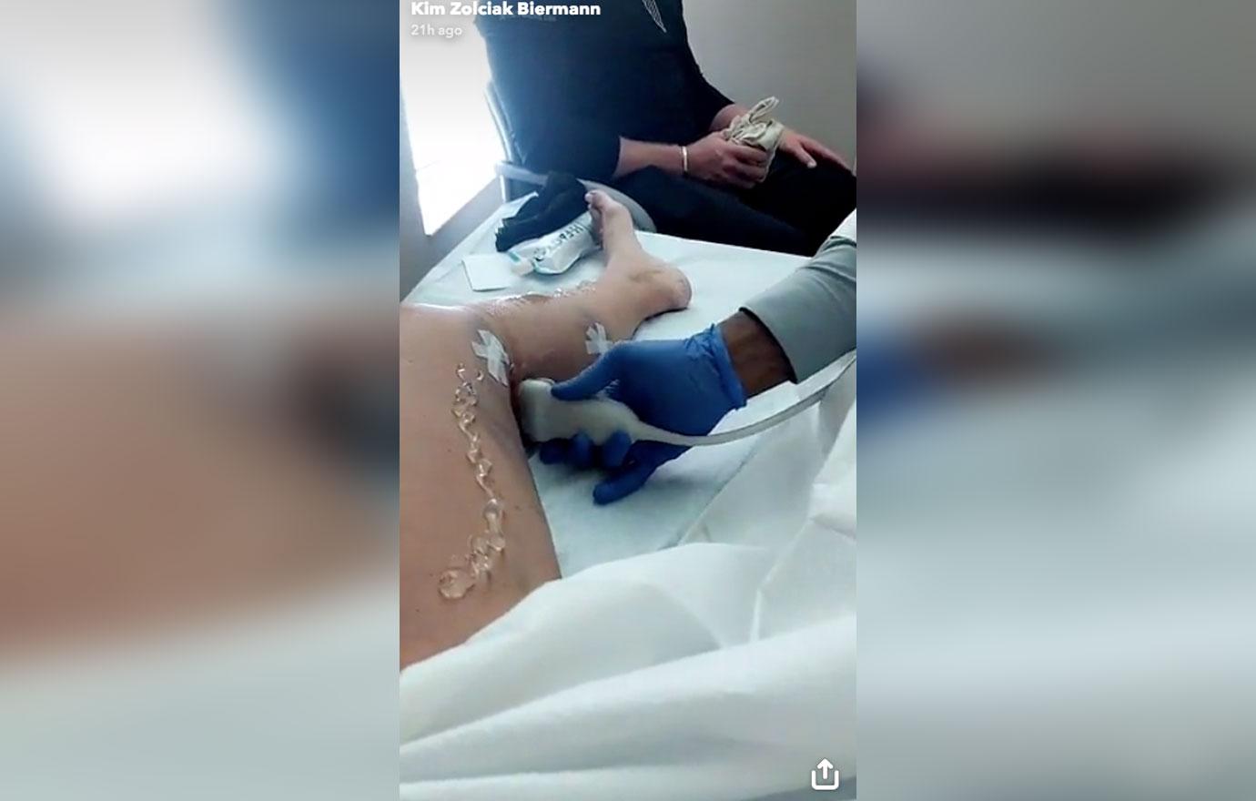 kim zolciak biermann surgery