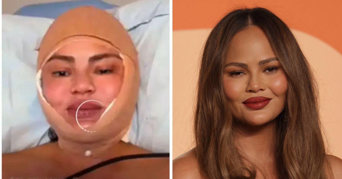 chrissy changes her hairline