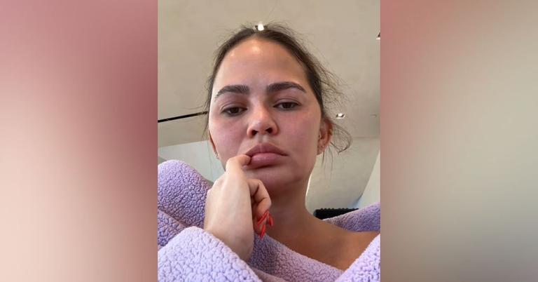 Chrissy Teigen Reveals She Has 'A Double Ear Infection'