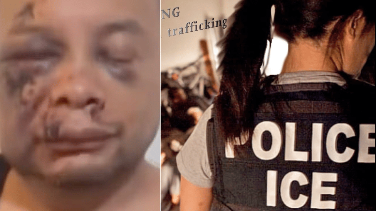 Image of Jose Mejia Hernandez was hospitalized with severe facial injuries, a broken collarbone and a life-threatening brain hemorrhage following his arrest by ICE agents.