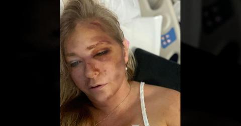 Virgina Giuffre Crash: No 'Reported' Injuries Despite Her Dying Claim