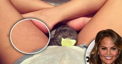 Chrissy teigen stretch marks instagram