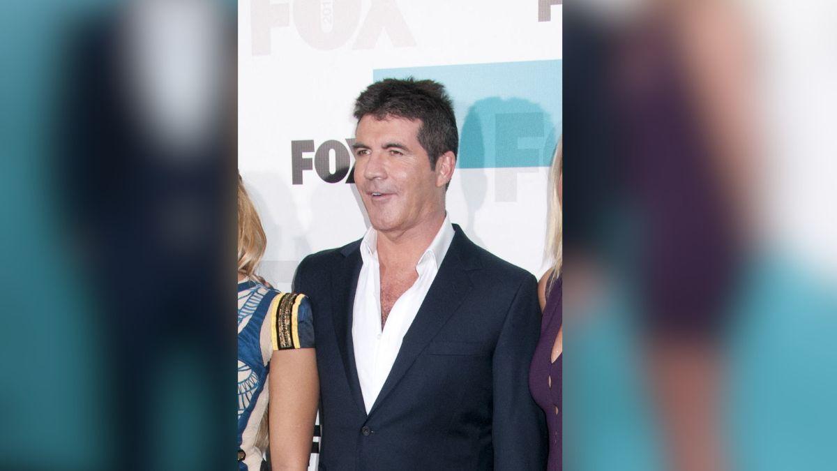 Image of Simon Cowell admitted to using fillers and Botox before deciding to stop. 