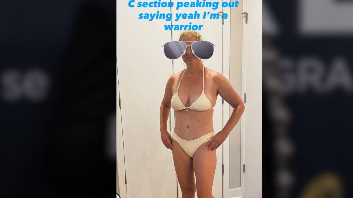 image of Amy Schumer