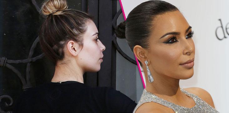 Kim kardashian hairline surgery HERO