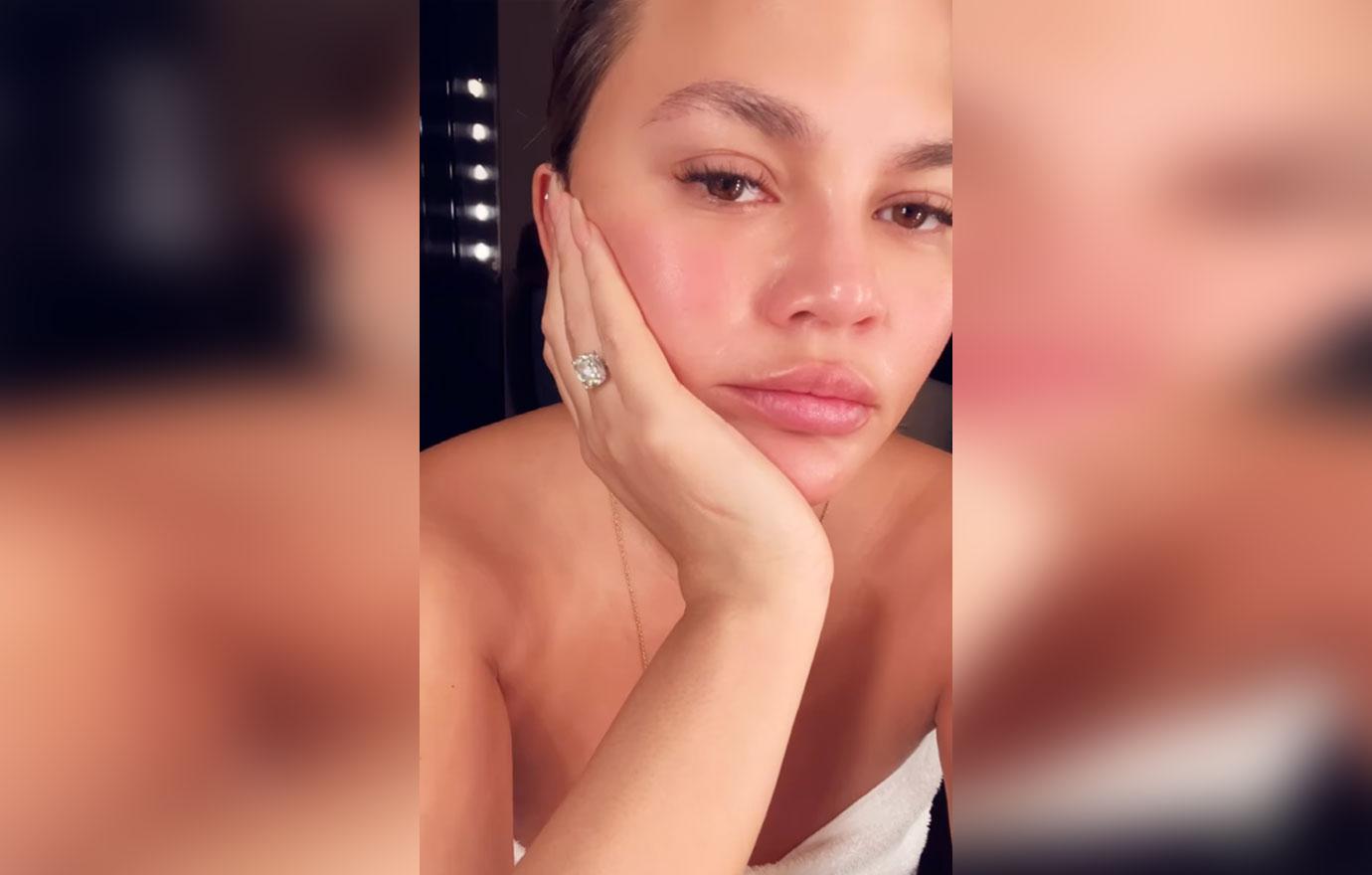 chrissy teigen new eyebrows transplants fat removal cheeks husband john legend