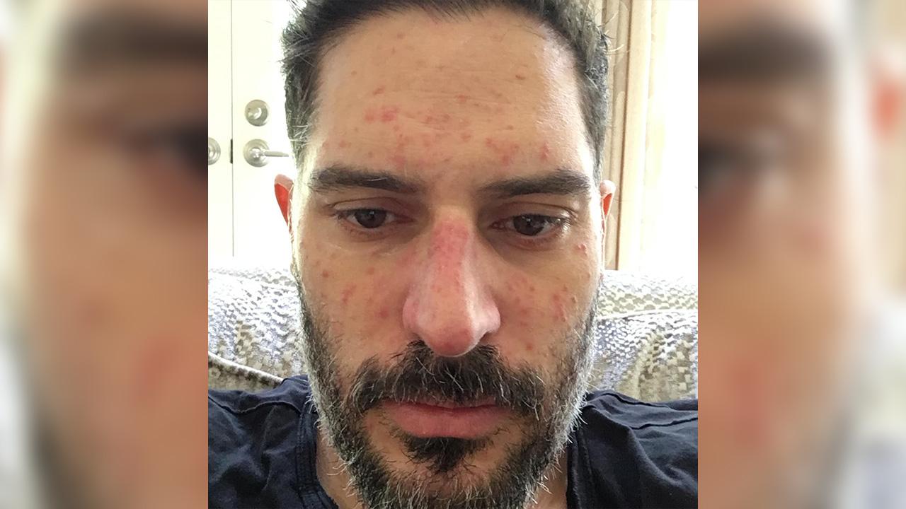 Image of Joe Manganiello's followers thanked him for being open about his struggles.