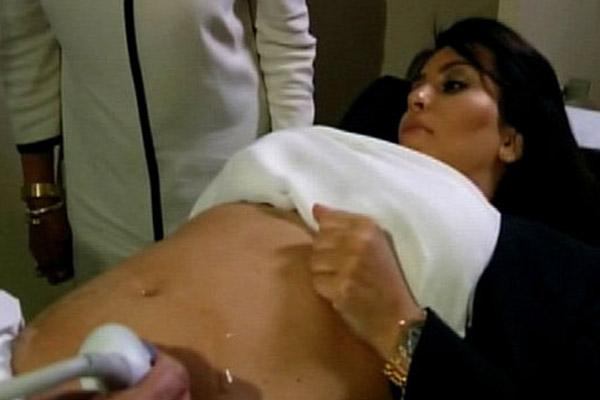 Kim kardashian sonogram