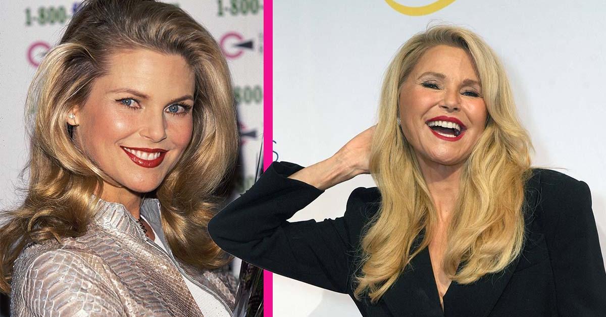 Did Christie Brinkley, 72, Have Plastic Surgery? Cosmetic Surgeon Reveals Potential Procedures Behind Her Ageless Glow - See Before-and-After Photos