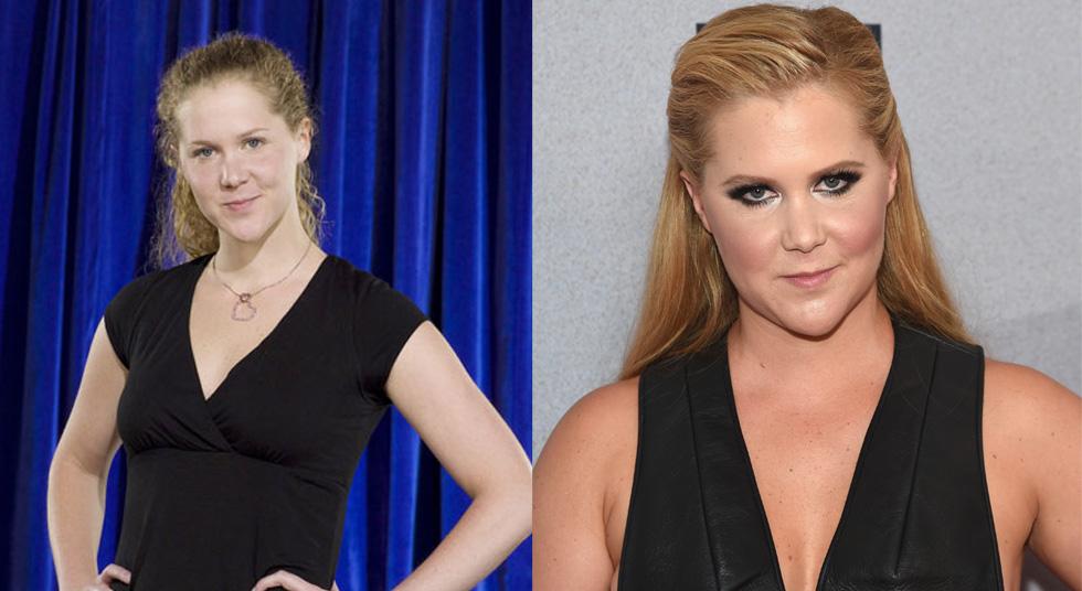 From Tears To Triumph Amy Schumer’s Epic Transformation In Photos