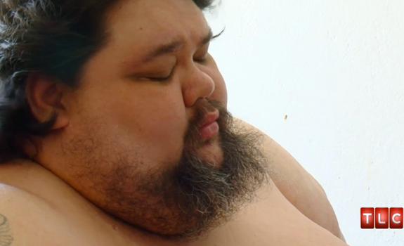 //_pound_man_video_struggles_lose_weight_surgery_stack_