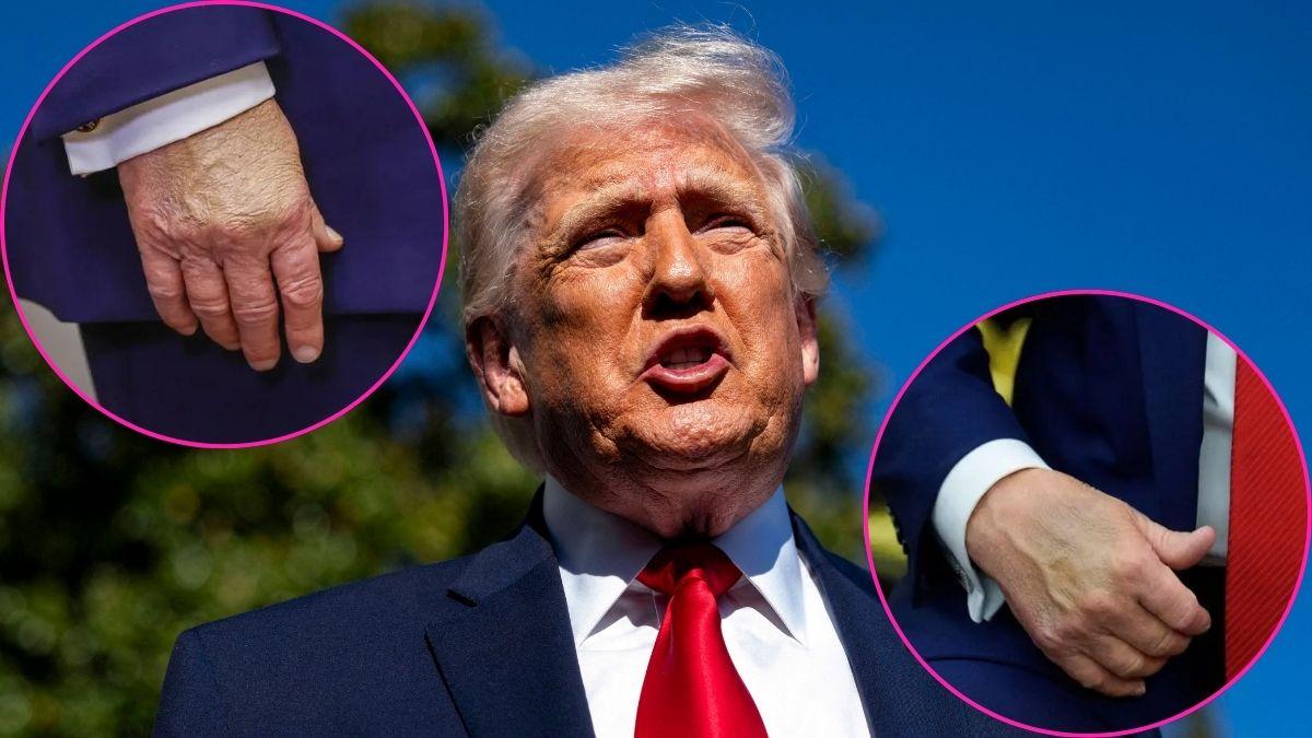 donald trump health concerns explained what to know so far
