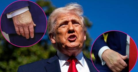donald trump health concerns explained what to know so far