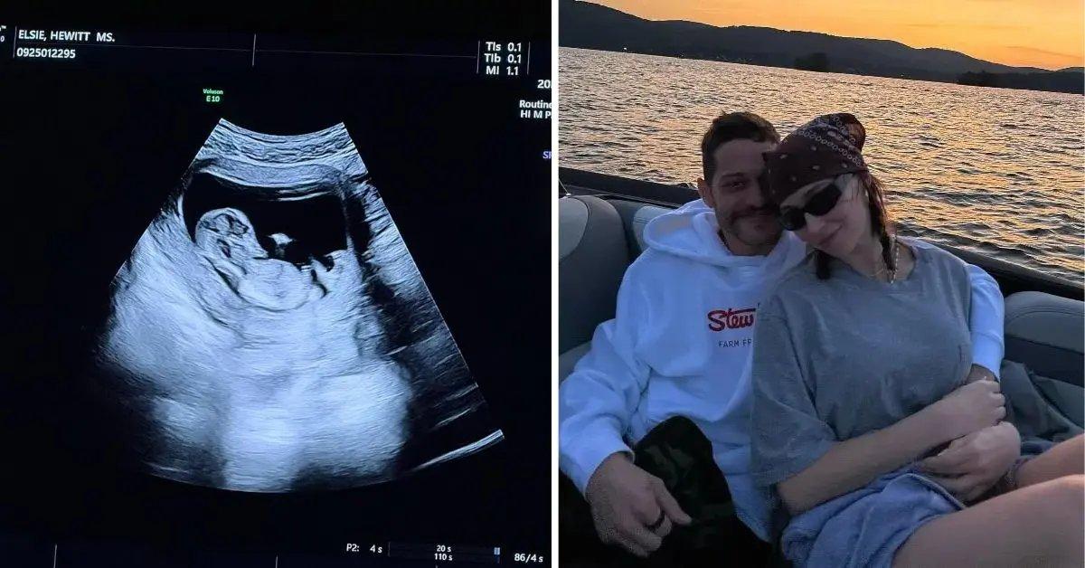 Photo of the comedian revealed it's been his 'dream' to become a father one day.
