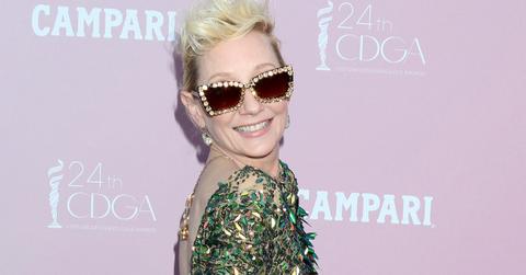 anne heche hospitalized severe burns fiery car crash