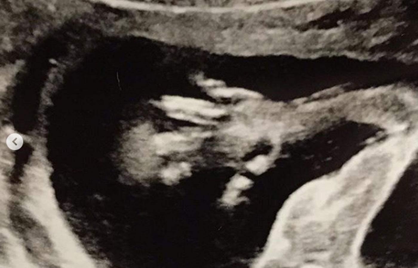 Counting on jessa duggar baby pregnant ultrasound photo 02