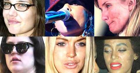 Celebrity skin problems pp ok long