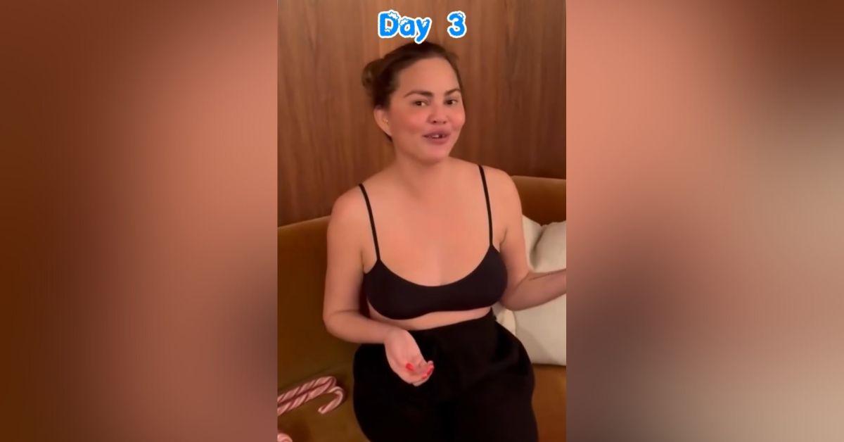 Image of Chrissy Teigen lost a tooth while opening a candy cane.