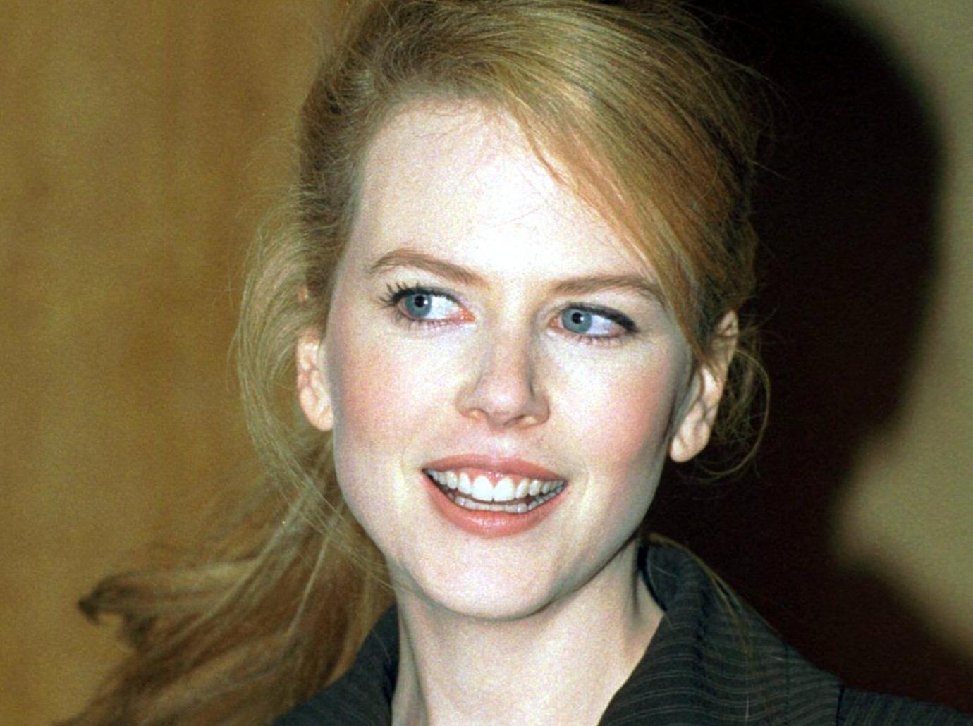 nicole kidman botox plastic surgery face apppearance transformation