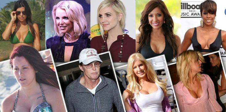 Celebrity plastic surgery