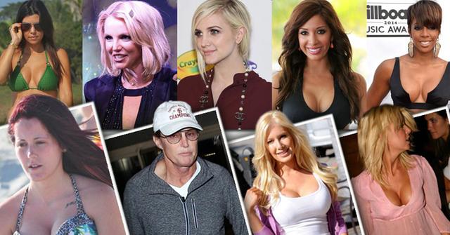 Celebrity plastic surgery