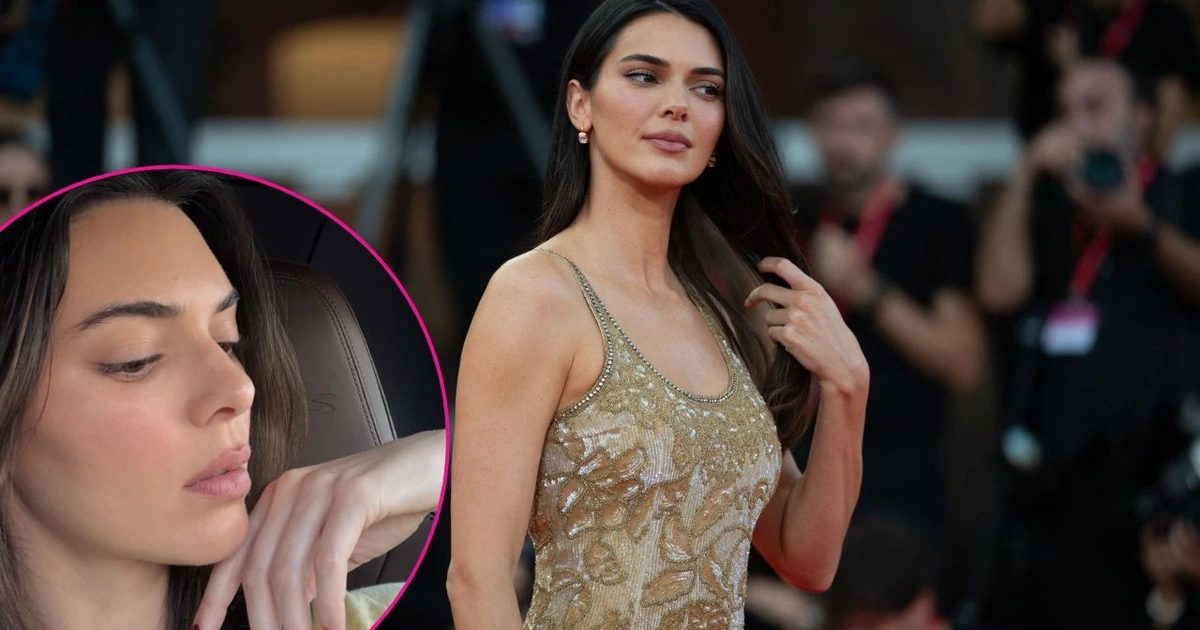 Kendall Jenner Says Her 'Skin Has Never Been Better'